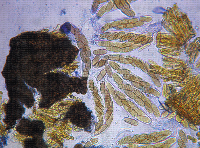 Ploeospora herbarum : pseudothèce et asques, ascospores sous le microscope